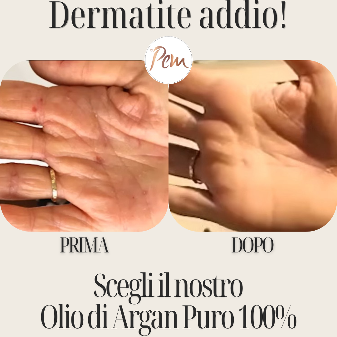 elimina dermatite con argan puro